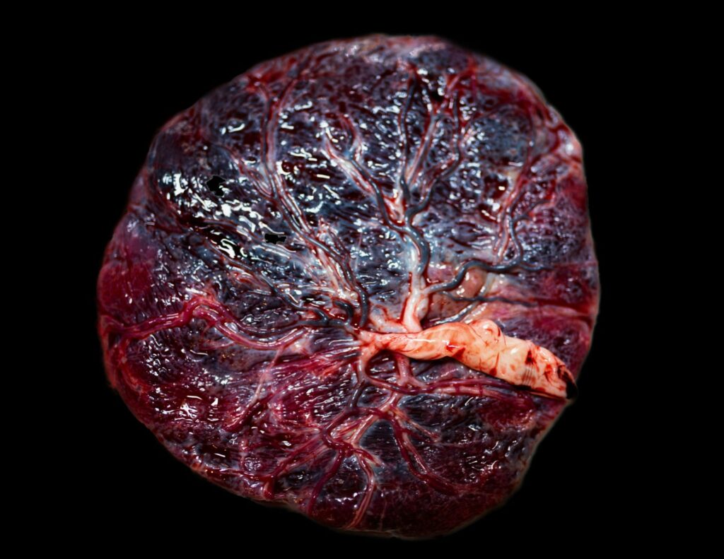 Top view of a Placenta and cord. Celebrities who eat their placenta are becoming popular in the United States.