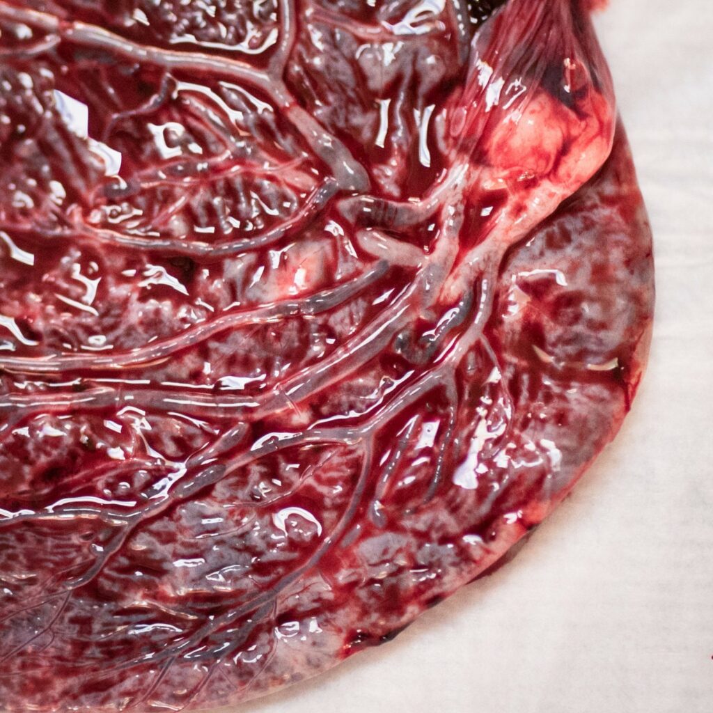 a beautiful piece of peace, aka the placenta photographed by Los Angeles Dear Birth