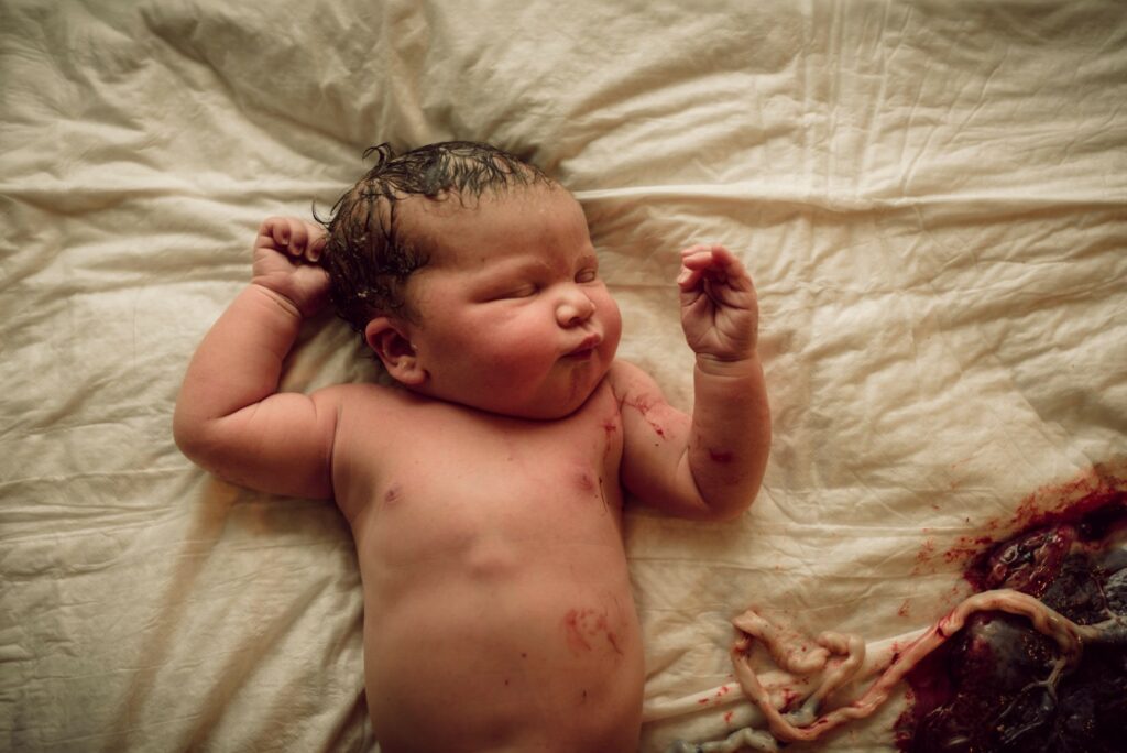 Color image captured by Dear Birth of newborn baby, still wearing her color and fluids of birth, lying next her placenta and waiting to be assessed by her midwife.