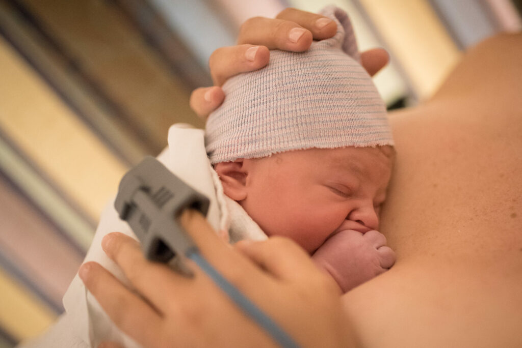 Beautiful Cesarean Birth Baby as photographed by Los Angeles birth photographer and Doula Diana Hinek for Dear Birth