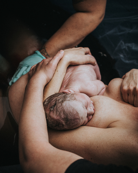 Image sample of birth photography: father and mother arms wrapped around a newborn minutes after birth. Courtesy of Los Angeles birth photography services Dear Birth