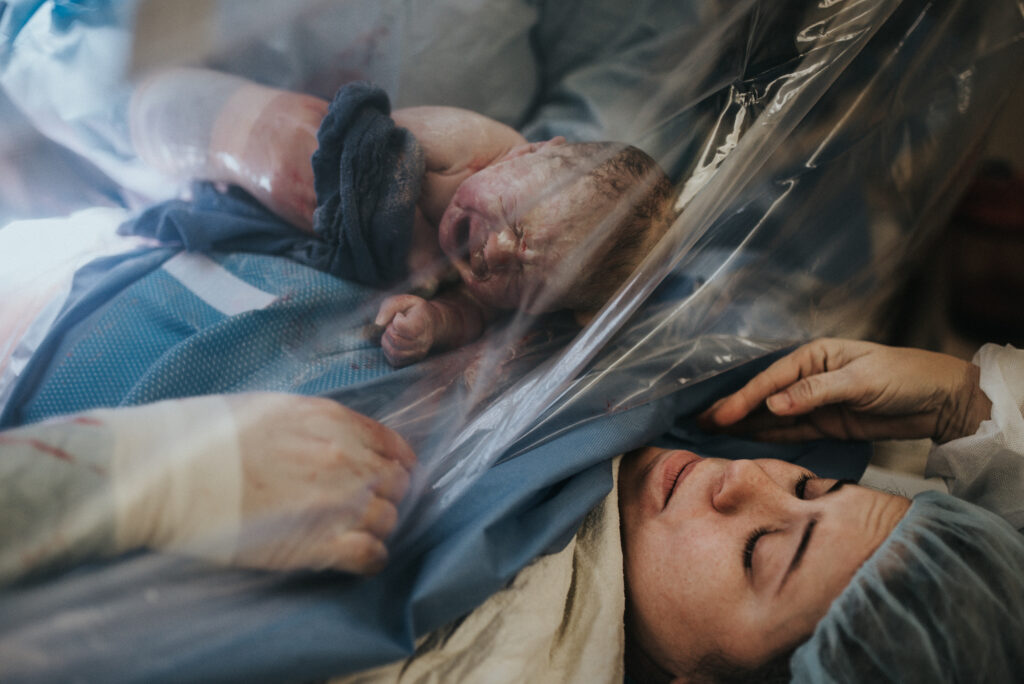 Celebrating Cesarean Awareness month photographed by Los Angeles birth photographer Diana Hinek for Dear Birth