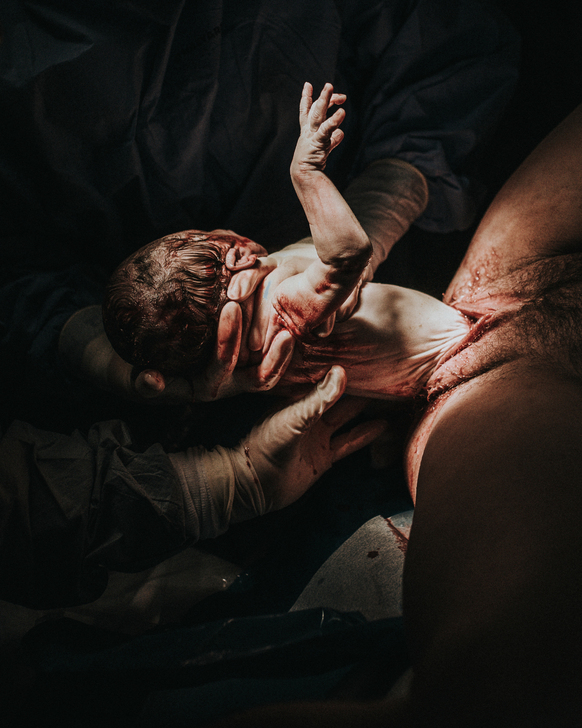 close up of baby being born as captured by Los Angeles Birth photographer and videographer Diana Hinek for Dear birth