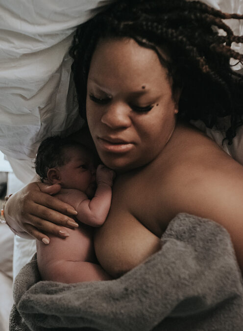 Birth Photography After a Cesarean